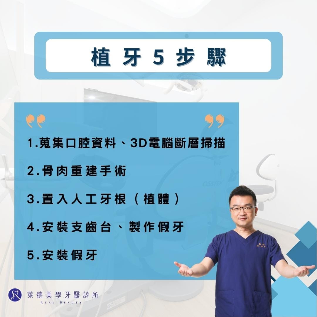 植牙5步驟