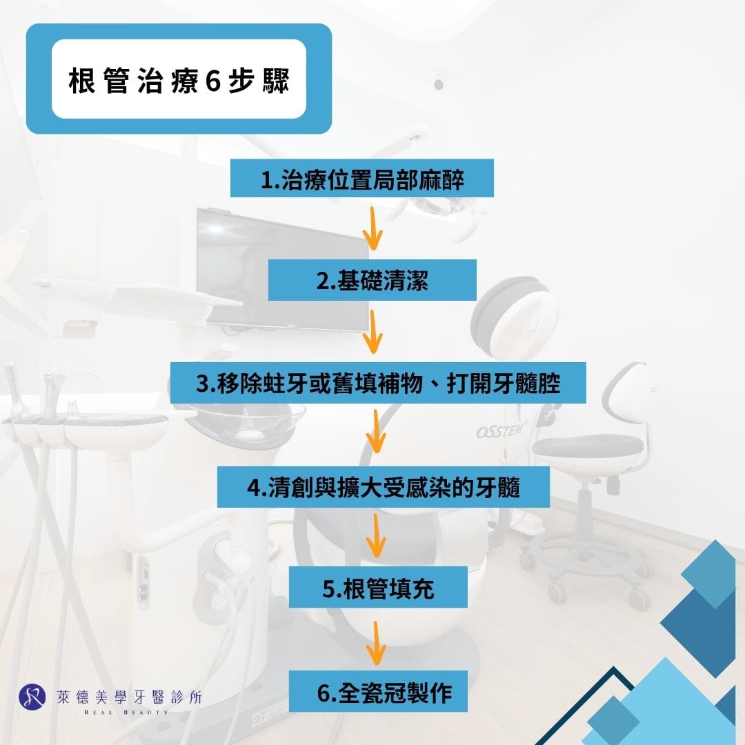 根管治療6步驟