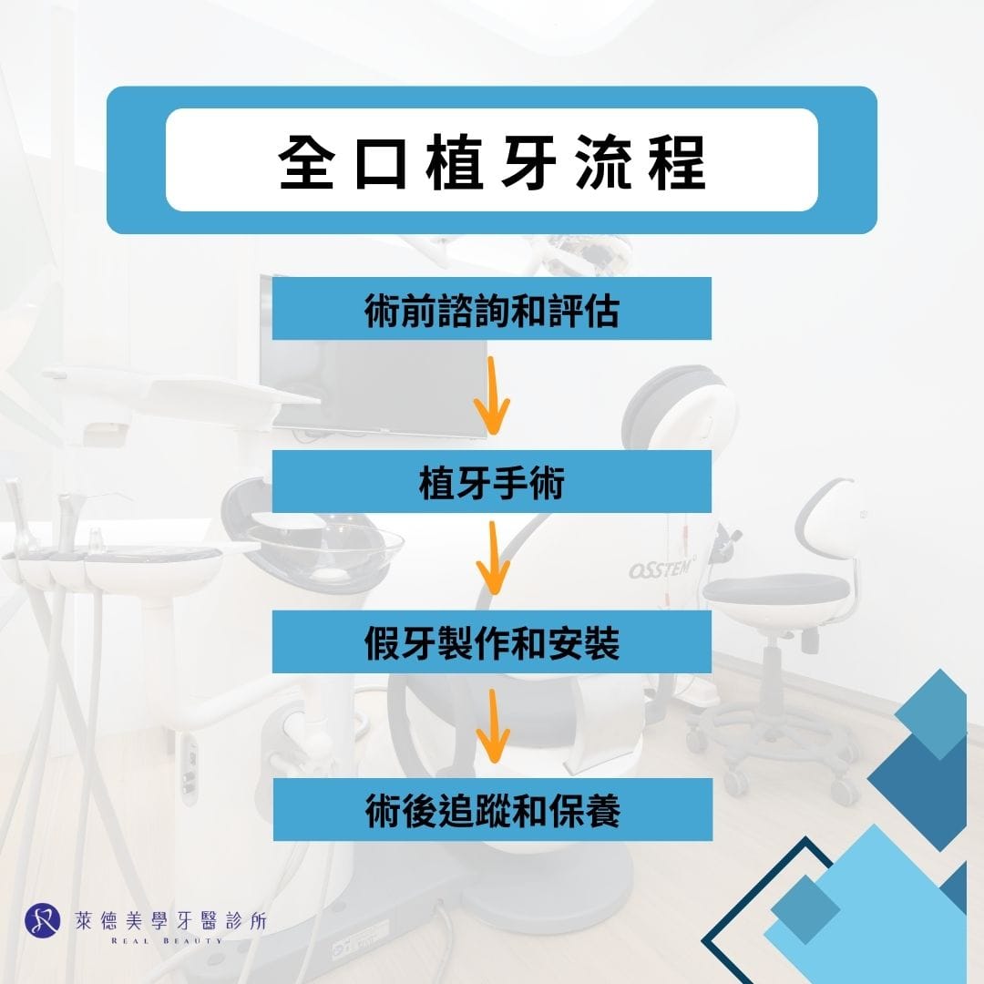 全口植牙流程