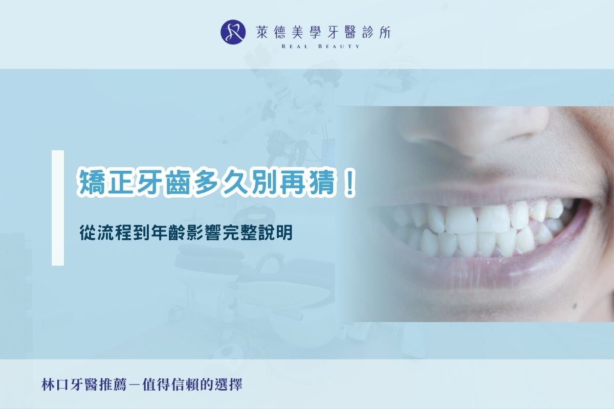 矯正牙齒多久別再猜!從流程到年齡影響完整說明