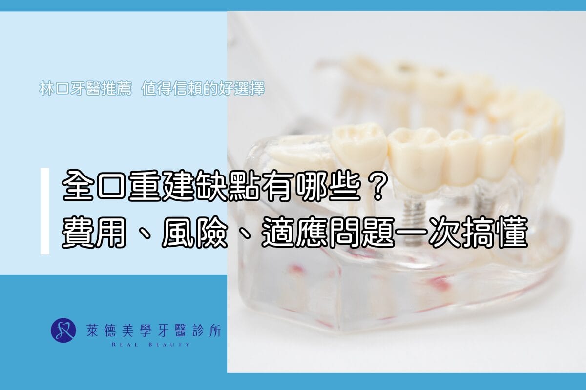 全口重建缺點有哪些？費用、風險、適應問題一次搞懂