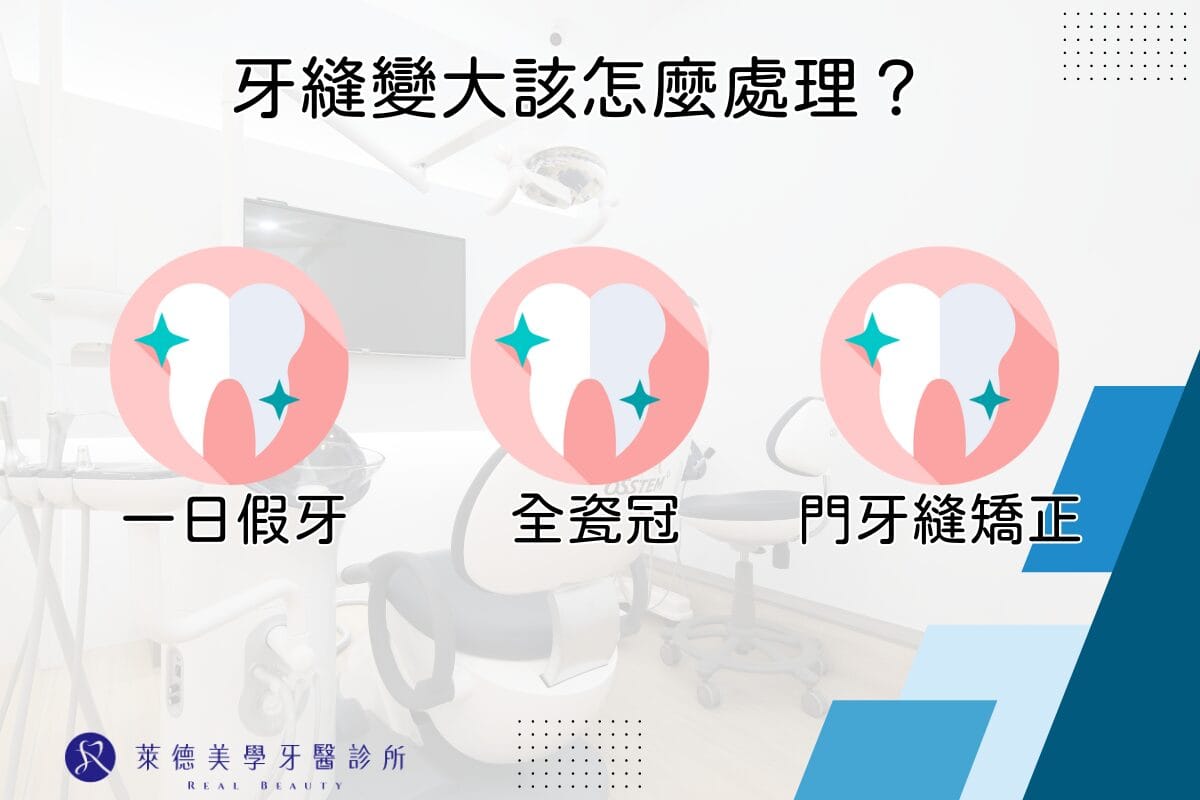 牙縫大怎麼辦?原因、症狀、解決方法一篇看懂! 1 牙縫變大的處理方式:一日假牙、全瓷冠、門牙縫矯正