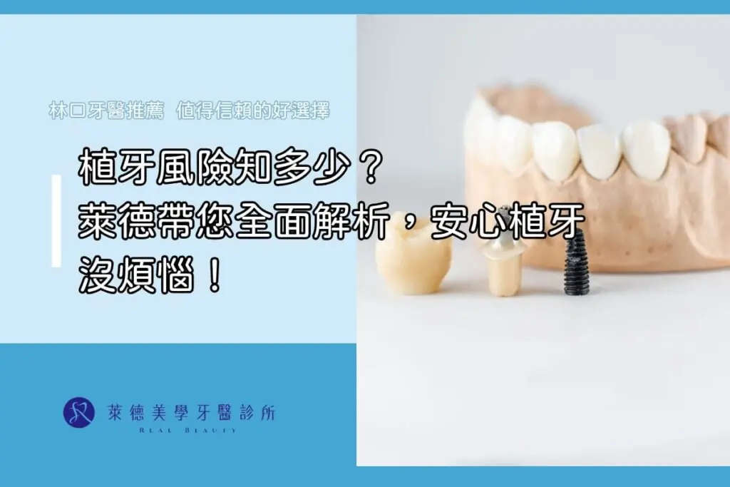 全口重建缺點有哪些？費用、風險、適應問題一次搞懂