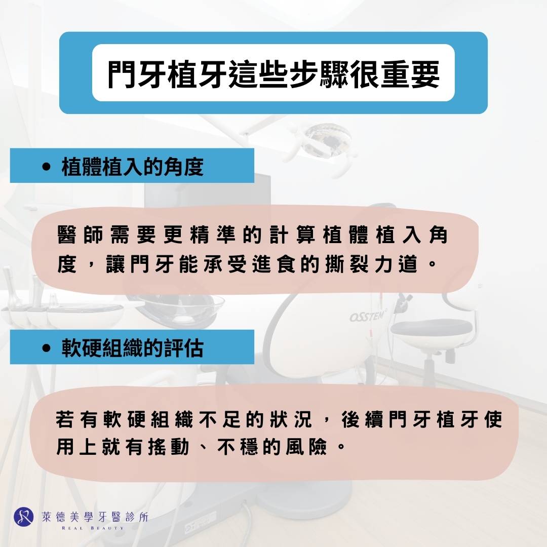 門牙植牙這些步驟很重要