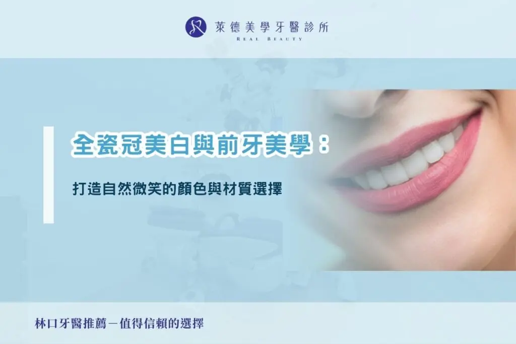 全瓷冠美白與前牙美學：打造自然微笑的顏色與材質選擇