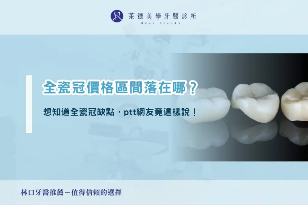 全瓷冠價格區間落在哪？想知道全瓷冠缺點，ptt網友竟這樣說