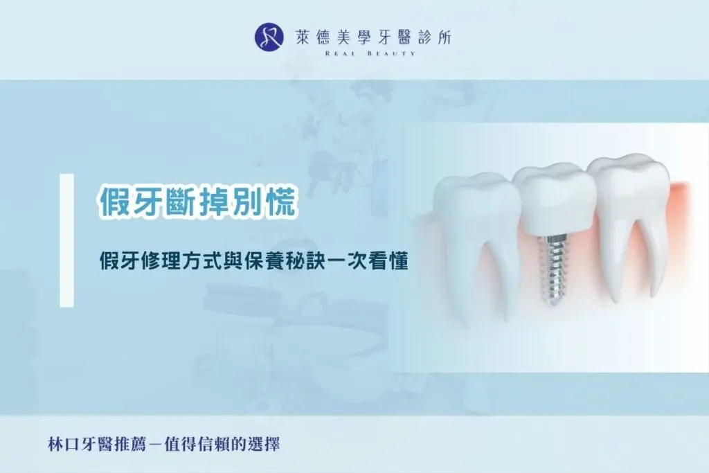 假牙斷掉別慌｜假牙修理方式與保養秘訣一次看懂