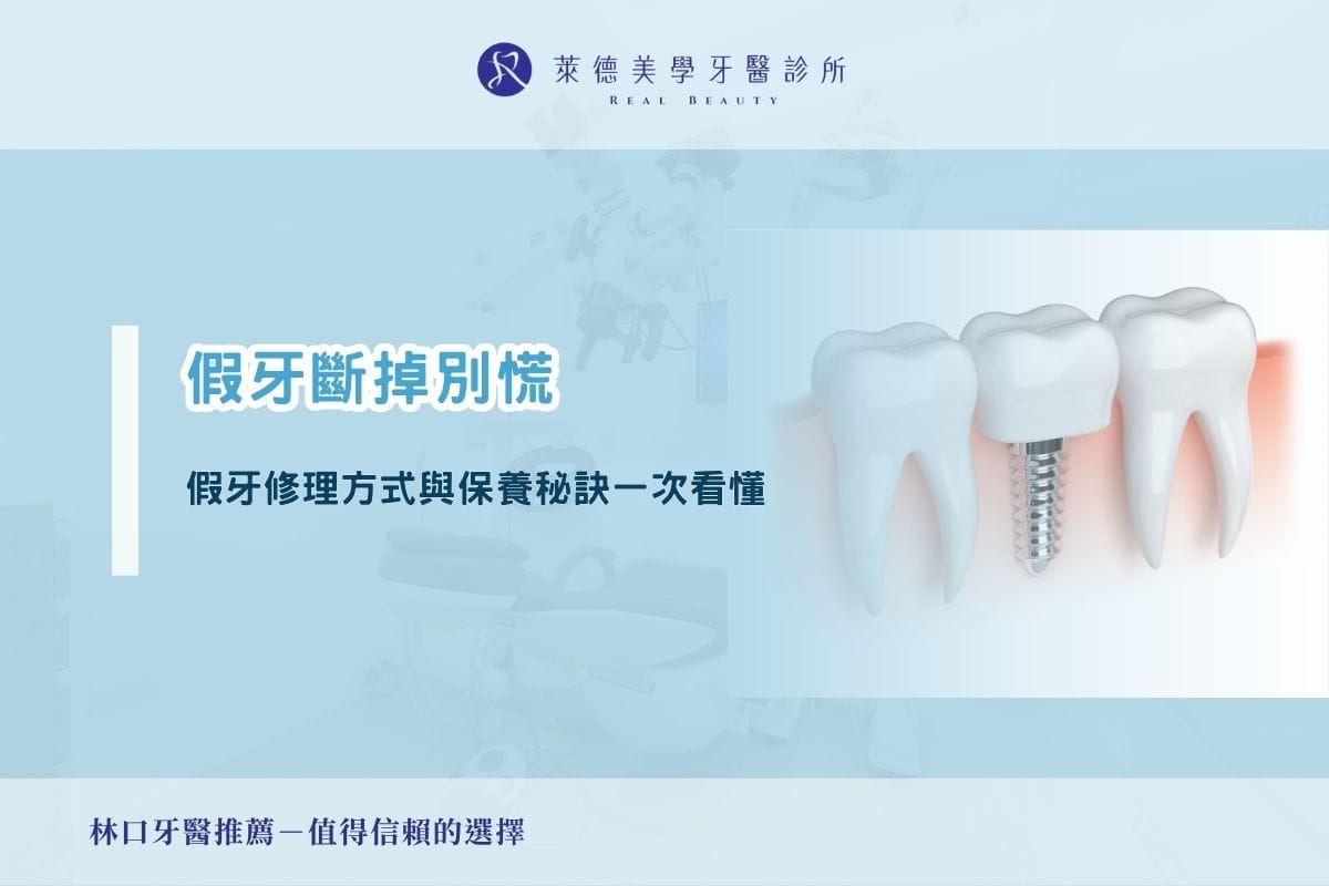 假牙斷掉別慌|假牙修理方式與保養秘訣一次看懂