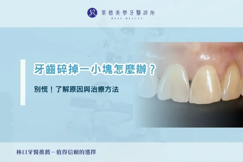 牙齒碎掉一小塊怎麼辦？別慌！了解原因與治療方法