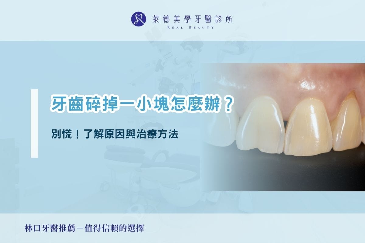 牙齒碎掉一小塊怎麼辦？別慌！了解原因與治療方法