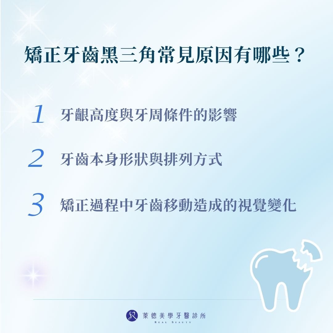 矯正牙齒黑三角常見原因有哪些？