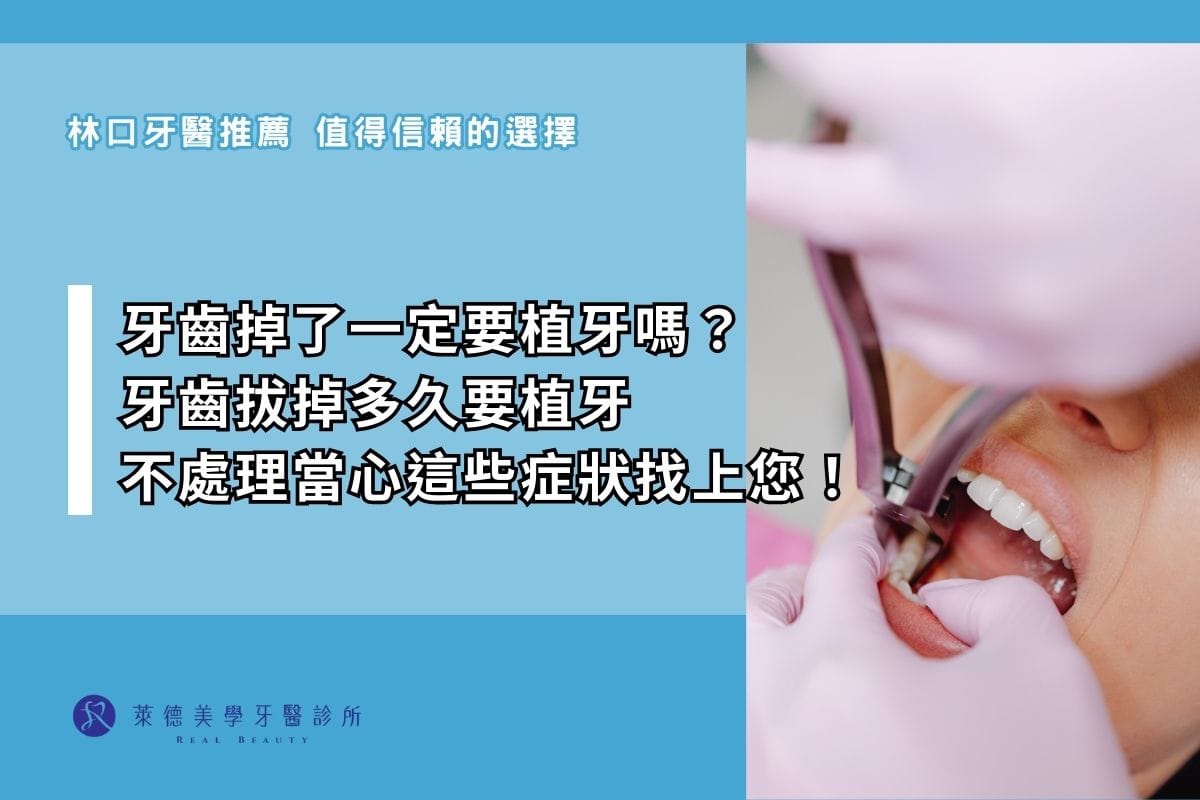 牙齒掉了一定要植牙嗎? 牙齒拔掉多久要植牙 不處理當心這些症狀找上您!