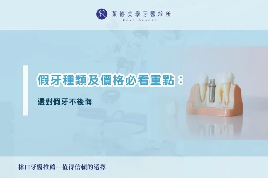 假牙種類及價格必看重點：選對假牙不後悔