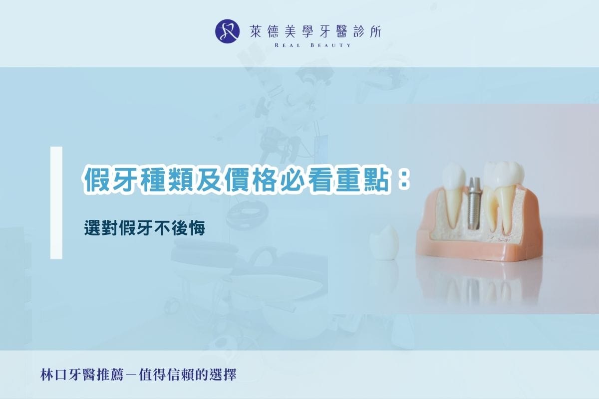 假牙種類及價格必看重點：選對假牙不後悔