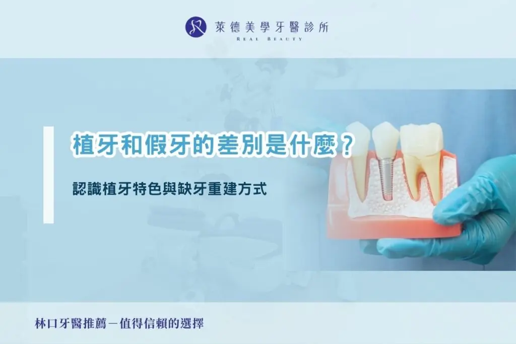 植牙和假牙的差別是什麼？認識植牙特色與缺牙重建方式