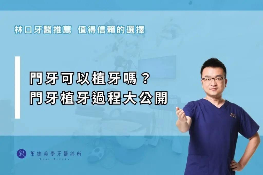 門牙可以植牙嗎