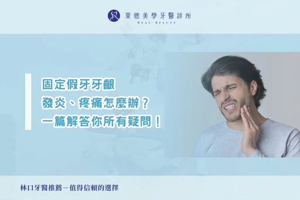 固定假牙牙齦發炎、疼痛怎麼辦？一篇解答你的所有疑問！