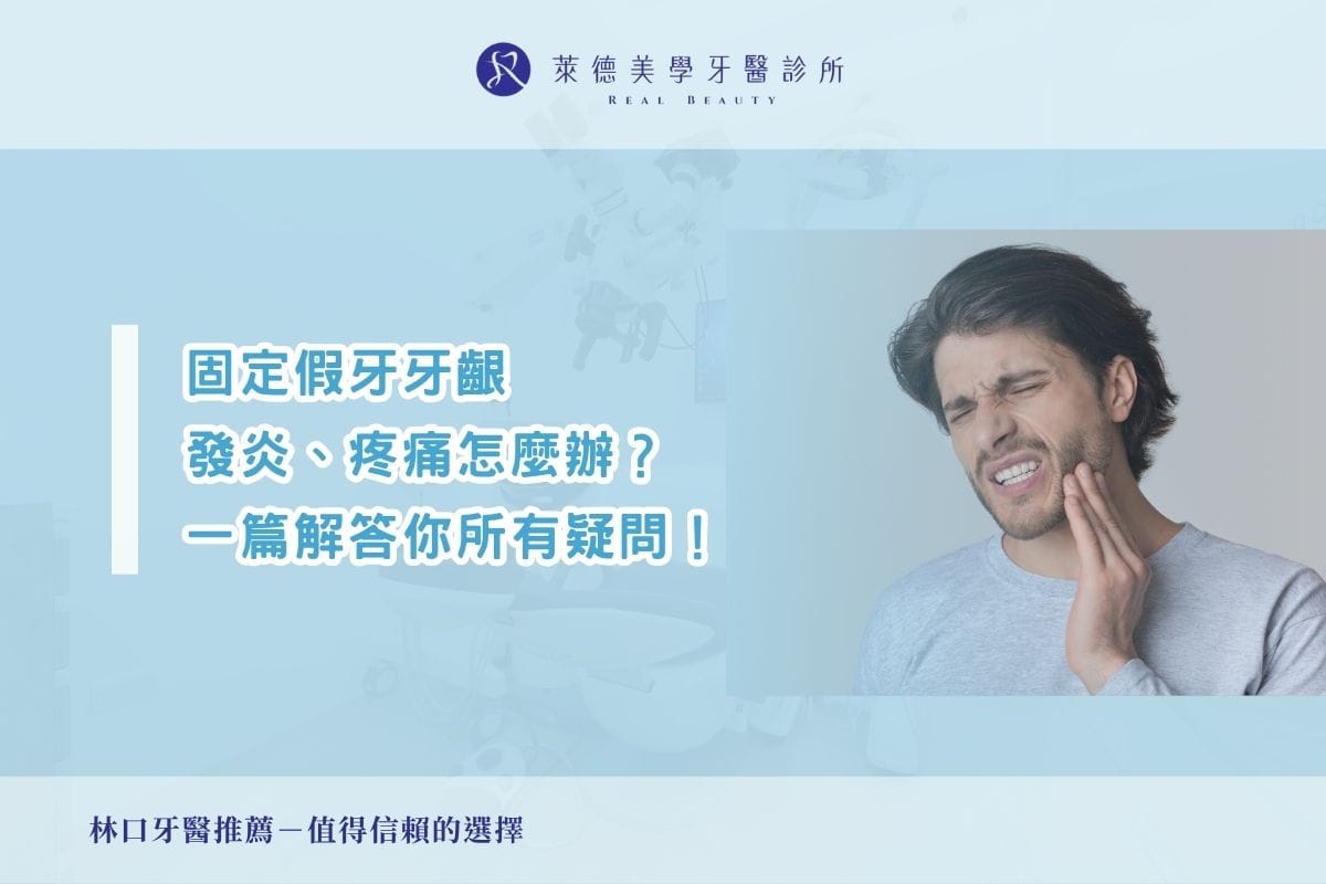 固定假牙牙齦發炎、疼痛怎麼辦?一篇解答你的所有疑問!
