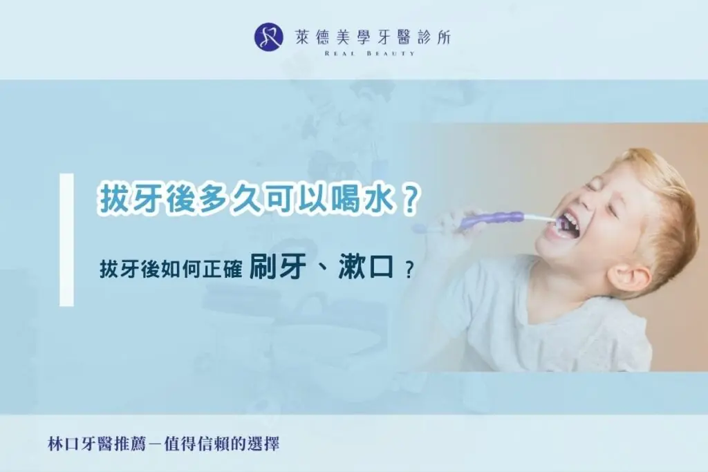 拔牙後多久可以喝水？拔牙後如何正確漱口、刷牙？