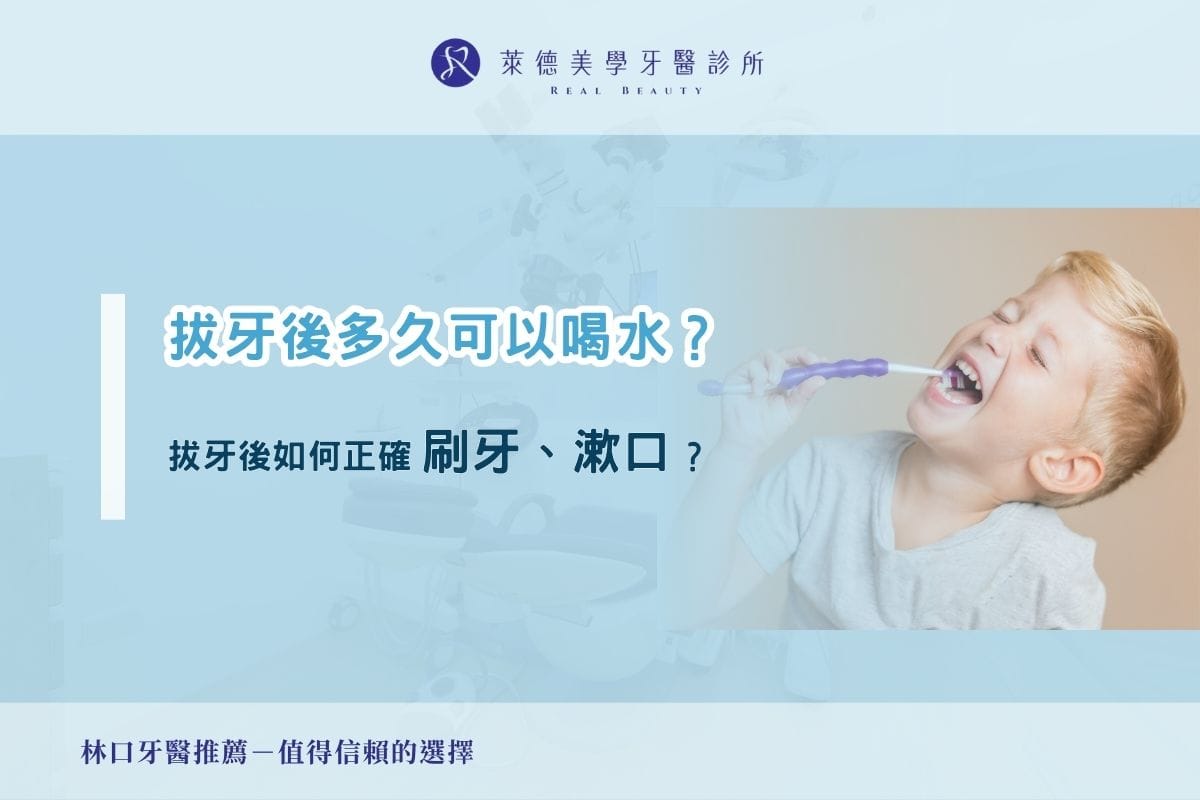 拔牙後多久可以喝水？拔牙後如何正確漱口、刷牙？