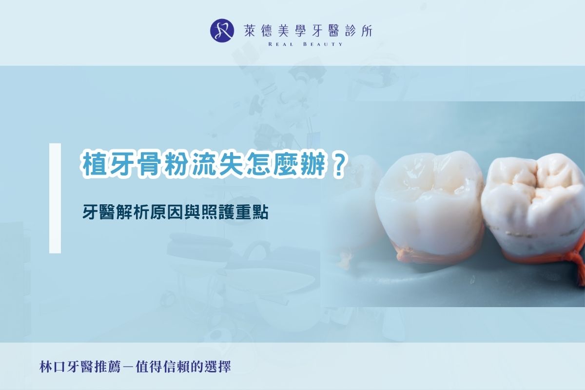 植牙骨粉流失怎麼辦?牙醫解析原因與照護重點