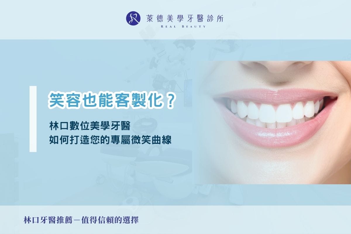 笑容也能客製化？林口數位美學牙醫如何打造您的專屬微笑曲線