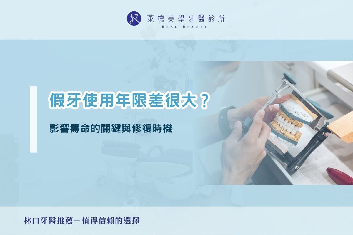 假牙使用年限差很大？影響壽命的關鍵與修復時機