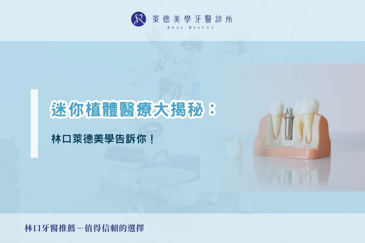 迷你植體醫療大揭秘：林口萊德美學告訴你！