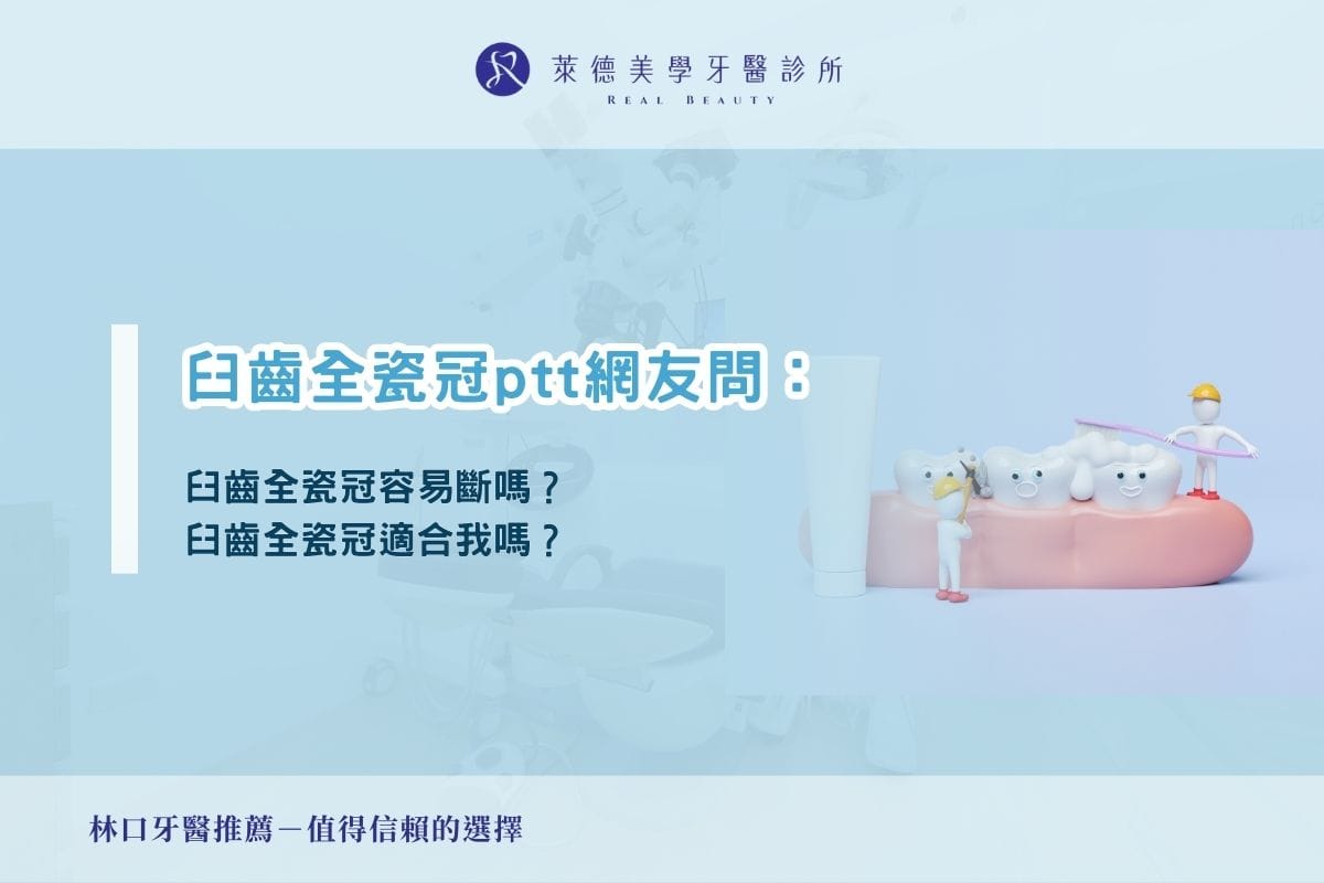 臼齒全瓷冠ptt網友問:臼齒全瓷冠容易斷嗎?臼齒全瓷冠適合我嗎?