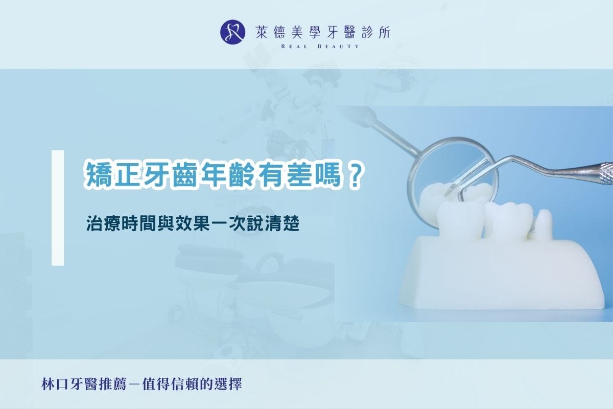 矯正牙齒年齡有差嗎？治療時間與效果一次說清楚