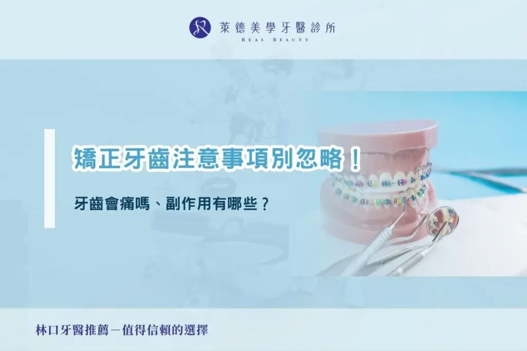 矯正牙齒注意事項別忽略!牙齒會痛嗎、副作用有哪些?