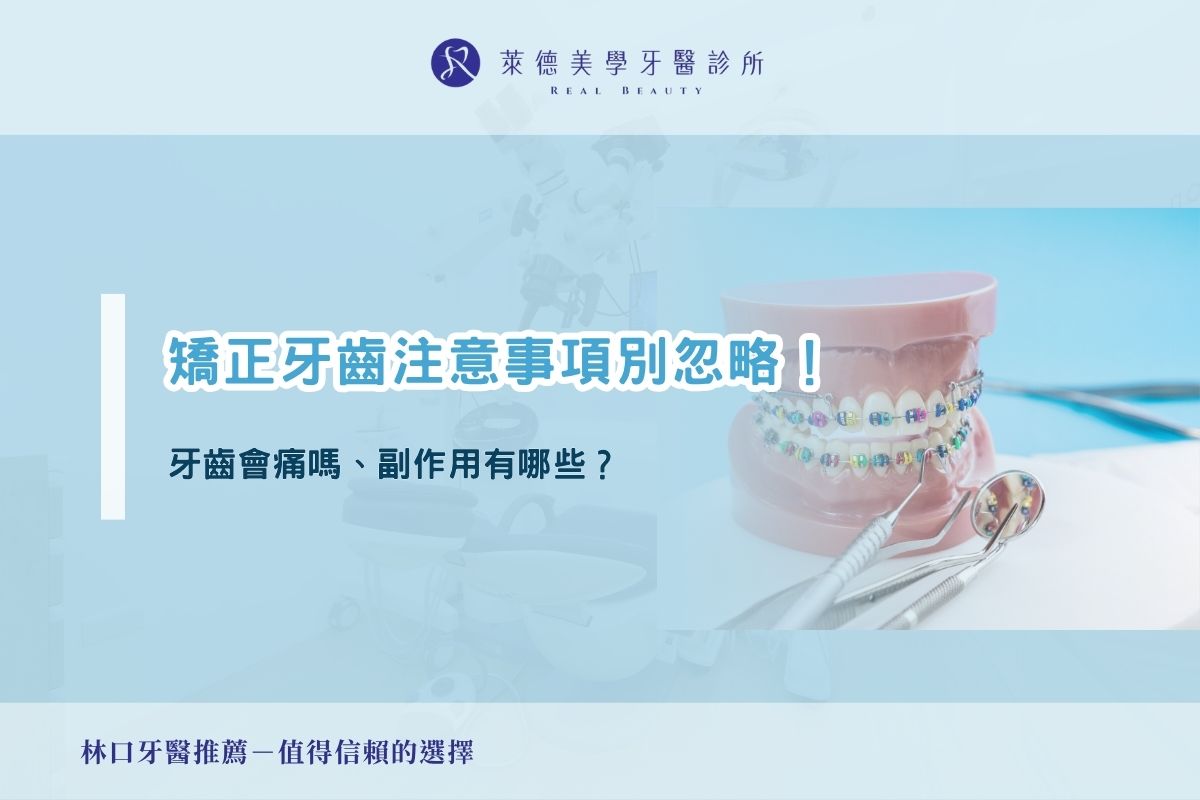 矯正牙齒注意事項別忽略!牙齒會痛嗎、副作用有哪些?