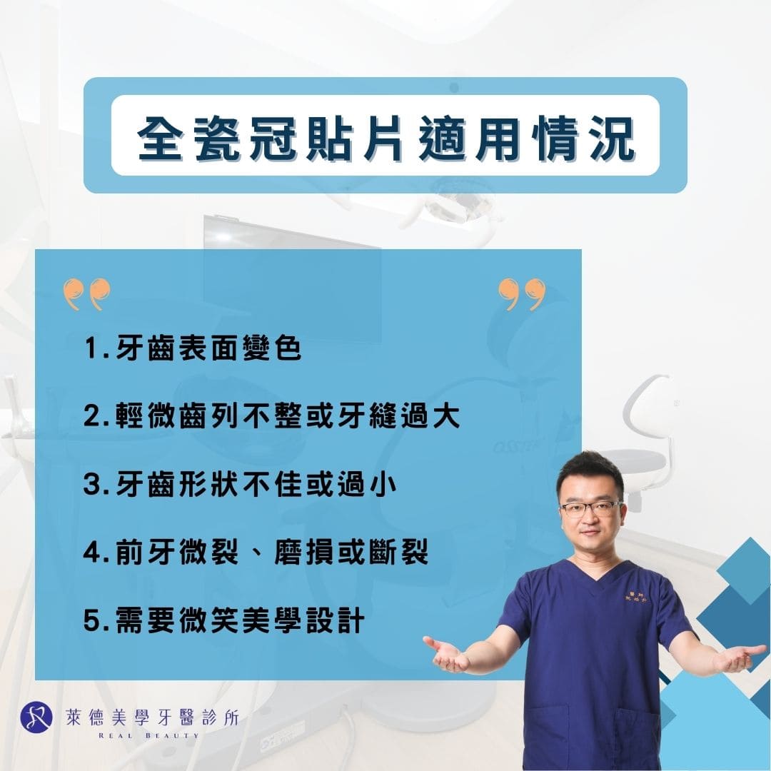 全瓷冠貼片適用情況