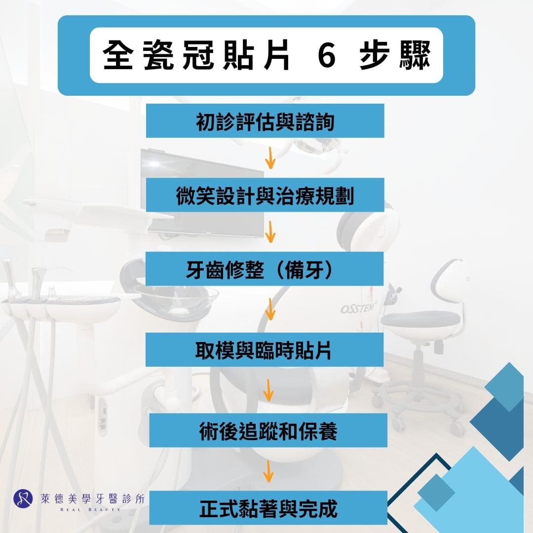 全瓷冠貼片6步驟