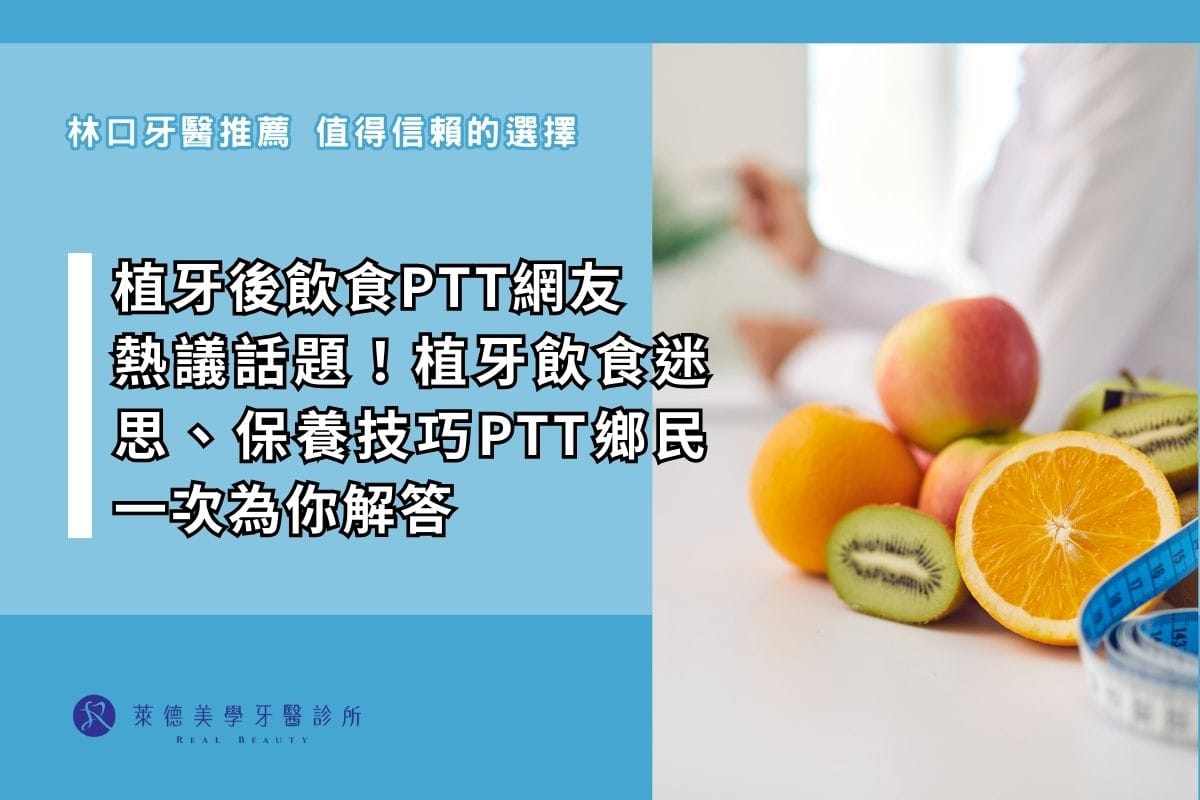 植牙後飲食ptt網友 熱議話題!植牙飲食迷思、保養技巧ptt鄉民一次為你解答