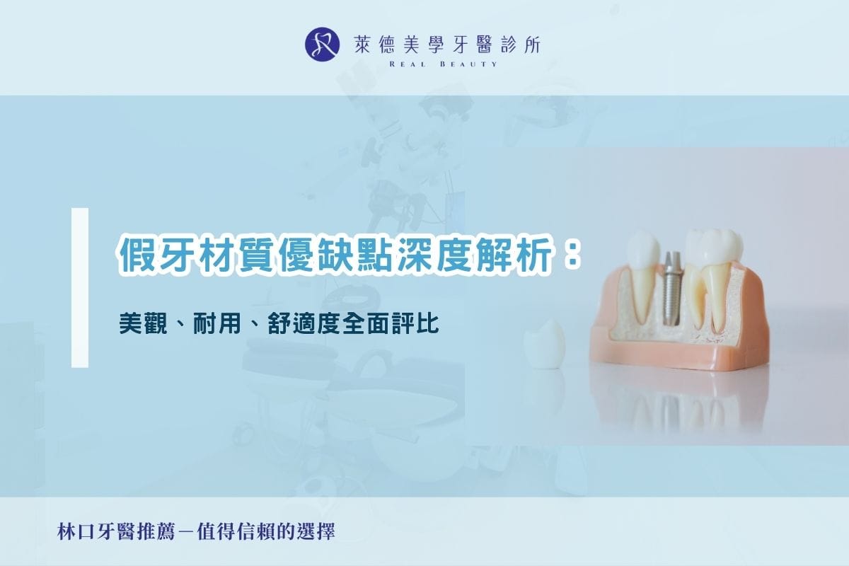 假牙材質優缺點深度解析:美觀、耐用、舒適度全面評比