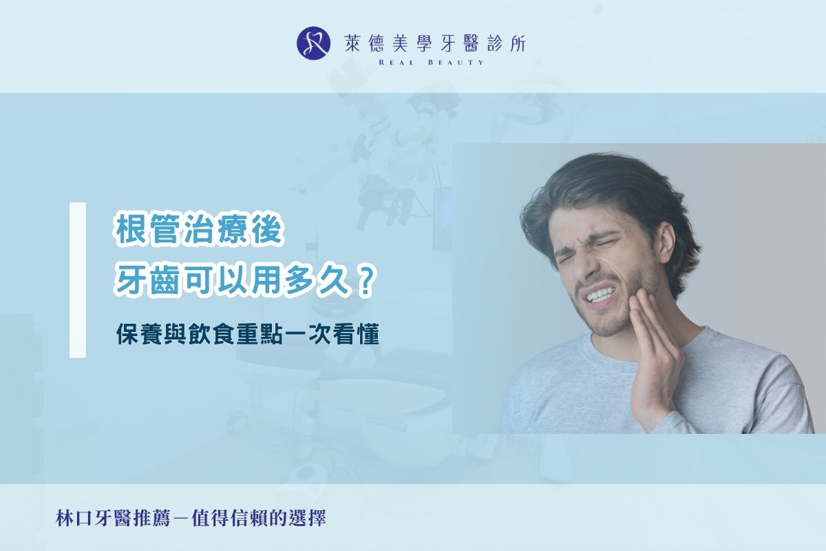 根管治療後牙齒可以用多久?保養與飲食重點一次看懂