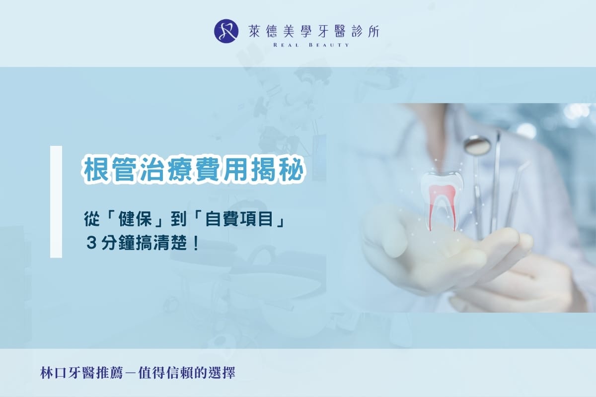 根管治療費用揭秘:從健保到自費項目三分鐘搞定