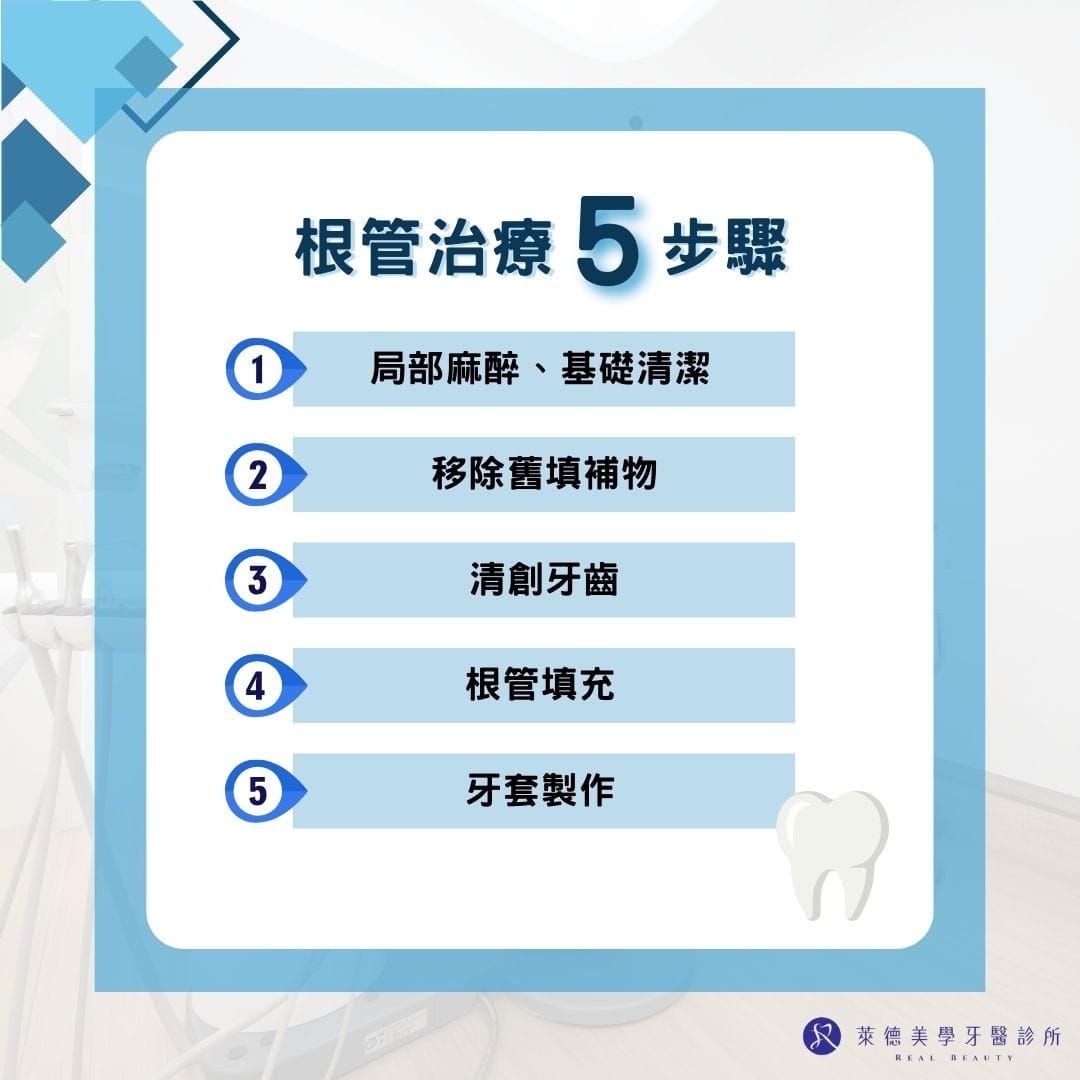 根管治療五步驟