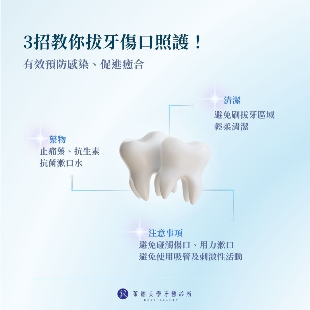拔牙傷口照護