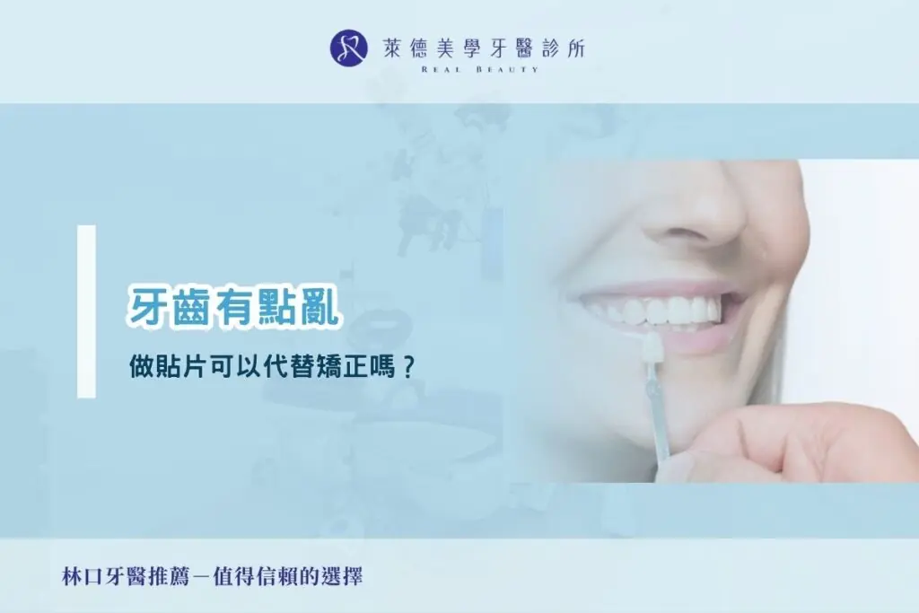 牙齒有點亂，做貼片可以代替矯正嗎？