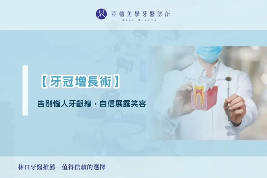 【牙冠增長術】告別惱人牙齦線，自信展露笑容