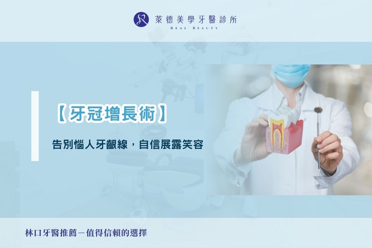 【牙冠增長術】告別惱人牙齦線,自信展露笑容