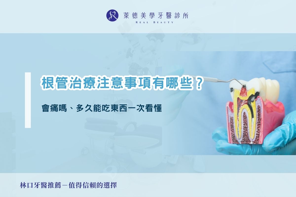 根管治療注意事項有哪些?會痛嗎、多久能吃東西一次看懂