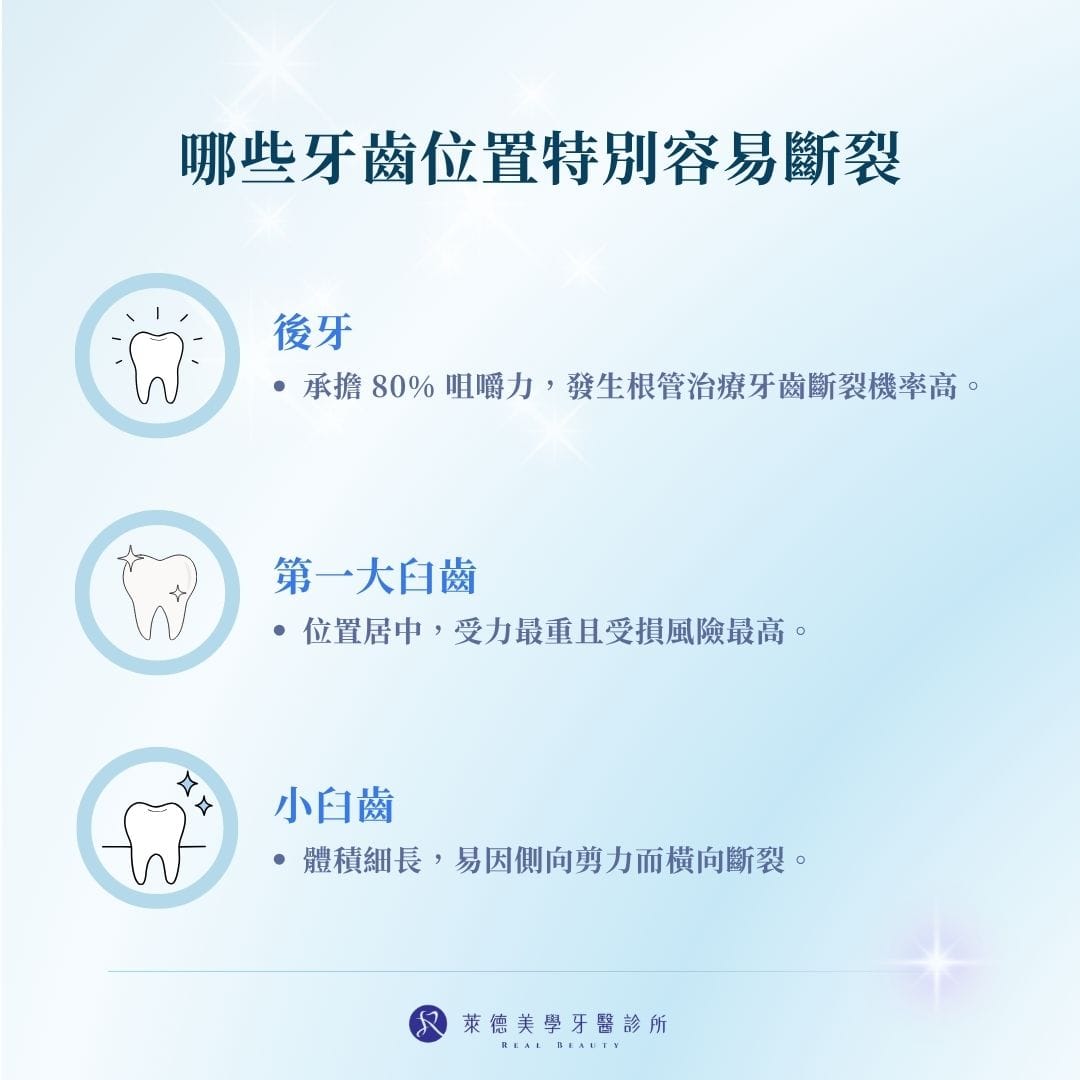 哪些牙齒位置特別容易斷裂