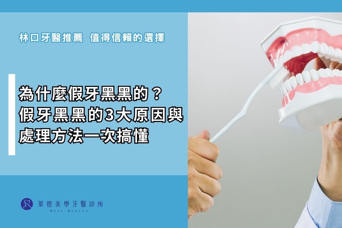 為什麼假牙黑黑的?假牙黑黑的3大原因與處理方法一次搞懂